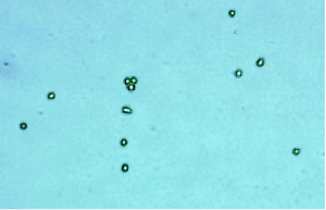 pancreas 1