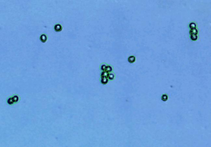 pancreas 2