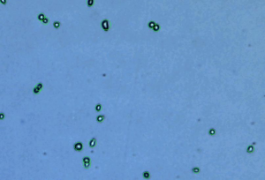 pancreas 3
