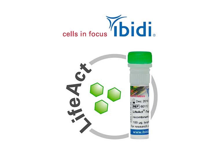 25% de descuento en mRNA LifeAct-TagGFP2 de ibidi